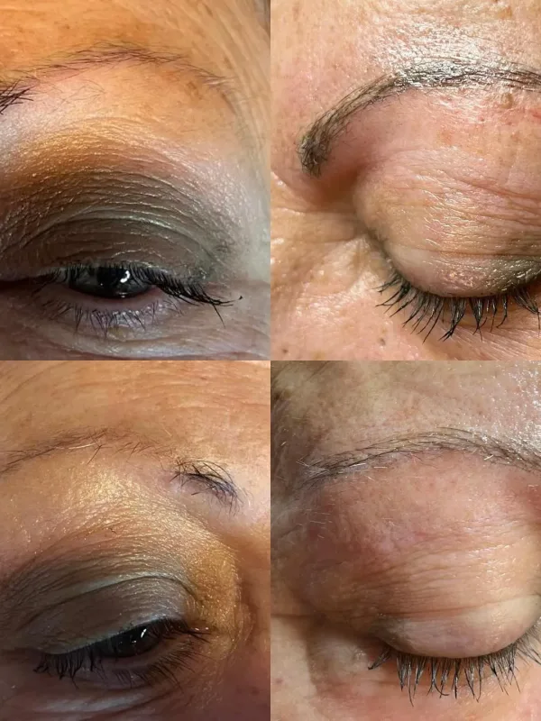 Collage de cejas antes y después de un tratamiento de reconstrucción o microblading en párpados envejecidos.
