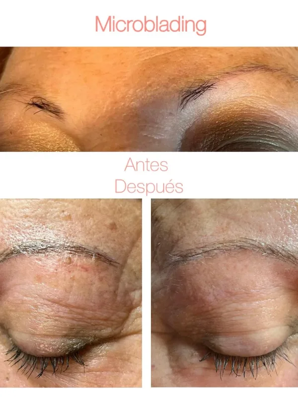 Comparativa de cejas antes y después de microblading en una mujer, con texto explicativo.
